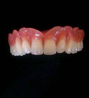 5a27bc7782718590e83cc3eaf68a13b6  charsoogh 1 300x333 - دندانسازی .دندان مصنوعی